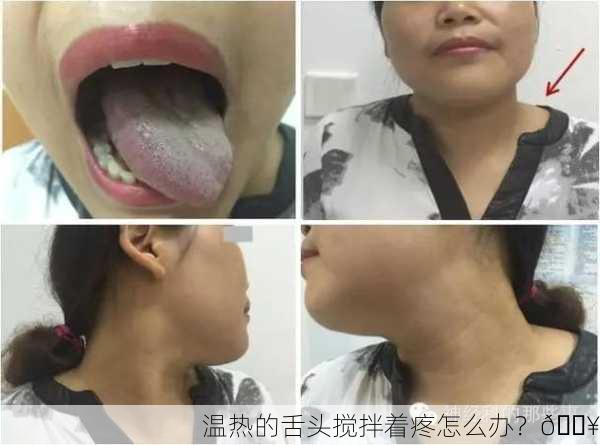 温热的舌头搅拌着疼怎么办？🔥