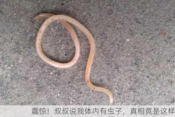 震惊！叔叔说我体内有虫子，真相竟是这样