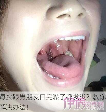 每次跟男朋友口完嗓子都发炎？教你解决办法！