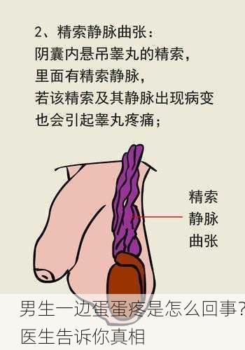 男生一边蛋蛋疼是怎么回事？医生告诉你真相