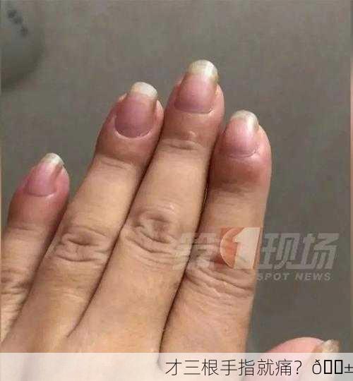 才三根手指就痛？😱