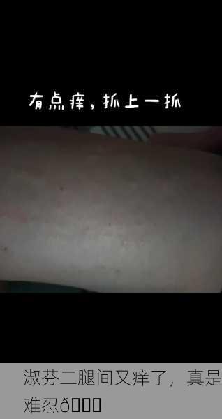淑芬二腿间又痒了，真是难忍😅