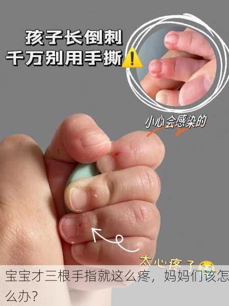 宝宝才三根手指就这么疼，妈妈们该怎么办？