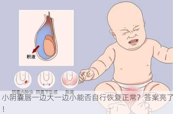 小阴囊唇一边大一边小能否自行恢复正常？答案亮了！