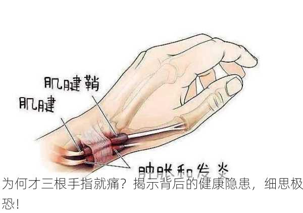 为何才三根手指就痛？揭示背后的健康隐患，细思极恐！