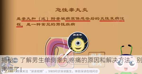 揭秘：了解男生单侧睾丸疼痛的原因和解决方法，别再懵了！