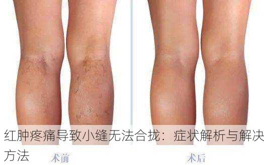 红肿疼痛导致小缝无法合拢：症状解析与解决方法
