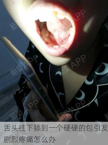 舌头往下舔到一个硬硬的包引发剧烈疼痛怎么办