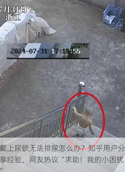 戴上尿锁无法排尿怎么办？知乎用户分享经验，网友热议“求助！我的小困扰”