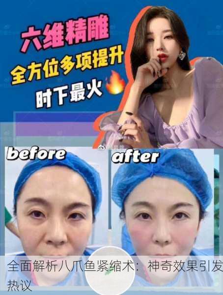 全面解析八爪鱼紧缩术：神奇效果引发热议