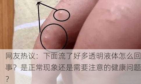 网友热议：下面流了好多透明液体怎么回事？是正常现象还是需要注意的健康问题？