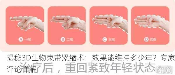 揭秘3D生物束带紧缩术：效果能维持多少年？专家评论详解