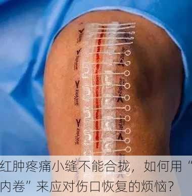 红肿疼痛小缝不能合拢，如何用“内卷”来应对伤口恢复的烦恼？