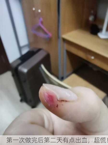 第一次做完后第二天有点出血，超慌！