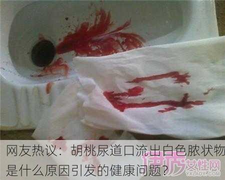 网友热议：胡桃尿道口流出白色脓状物是什么原因引发的健康问题？