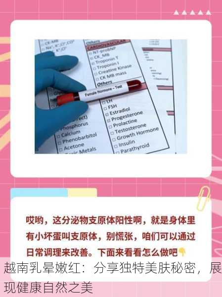 越南乳晕嫩红：分享独特美肤秘密，展现健康自然之美