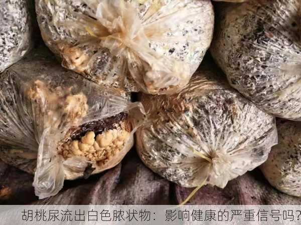 胡桃尿流出白色脓状物：影响健康的严重信号吗？