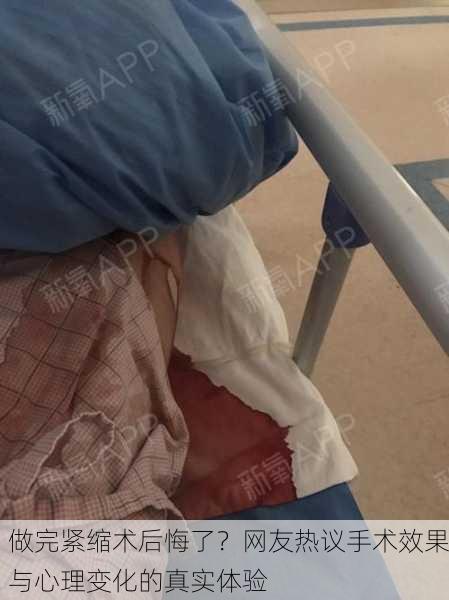 做完紧缩术后悔了？网友热议手术效果与心理变化的真实体验