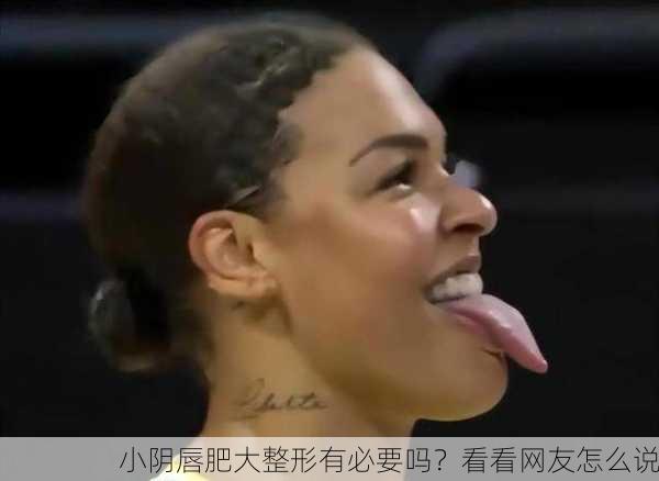 小阴唇肥大整形有必要吗？看看网友怎么说