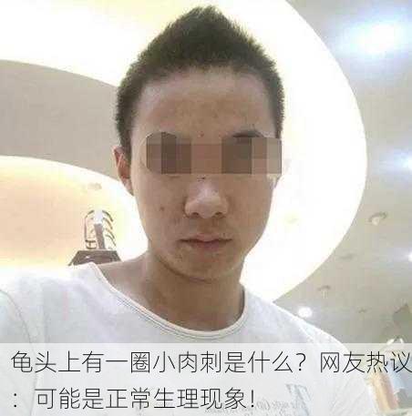 龟头上有一圈小肉刺是什么？网友热议：可能是正常生理现象！