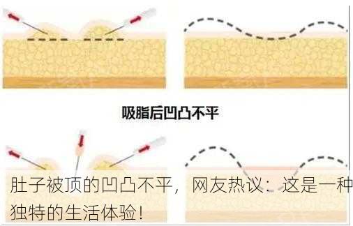 肚子被顶的凹凸不平，网友热议：这是一种独特的生活体验！