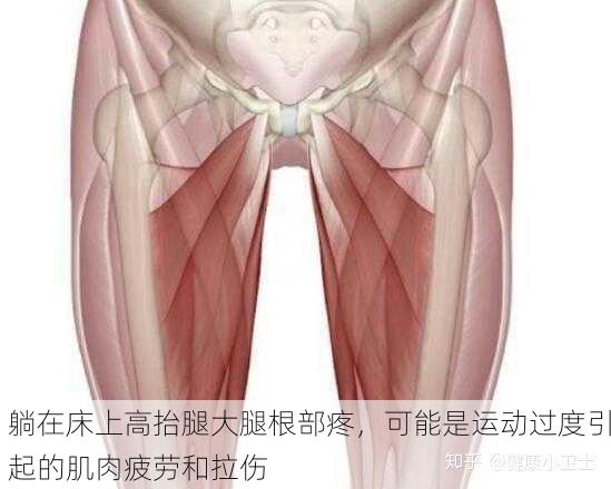 躺在床上高抬腿大腿根部疼，可能是运动过度引起的肌肉疲劳和拉伤