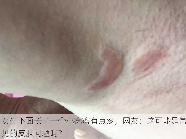 女生下面长了一个小疙瘩有点疼，网友：这可能是常见的皮肤问题吗？