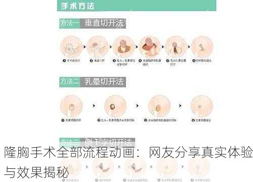隆胸手术全部流程动画：网友分享真实体验与效果揭秘